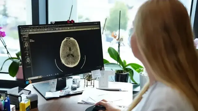 Küme baş ağrısı nedir, belirtileri nelerdir? Uzmanından önemli uyarılar