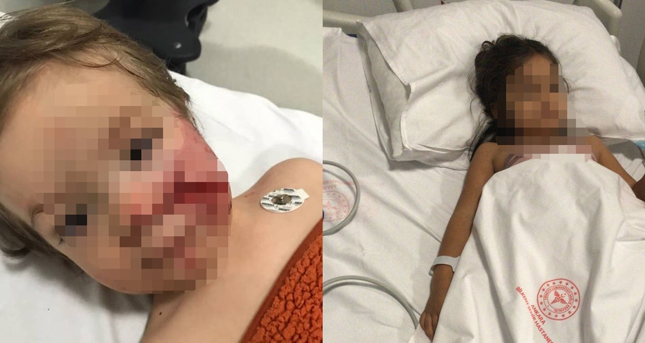 Bakan Yerlikaya duyurdu: Pitbull’un sahibi tutuklandı