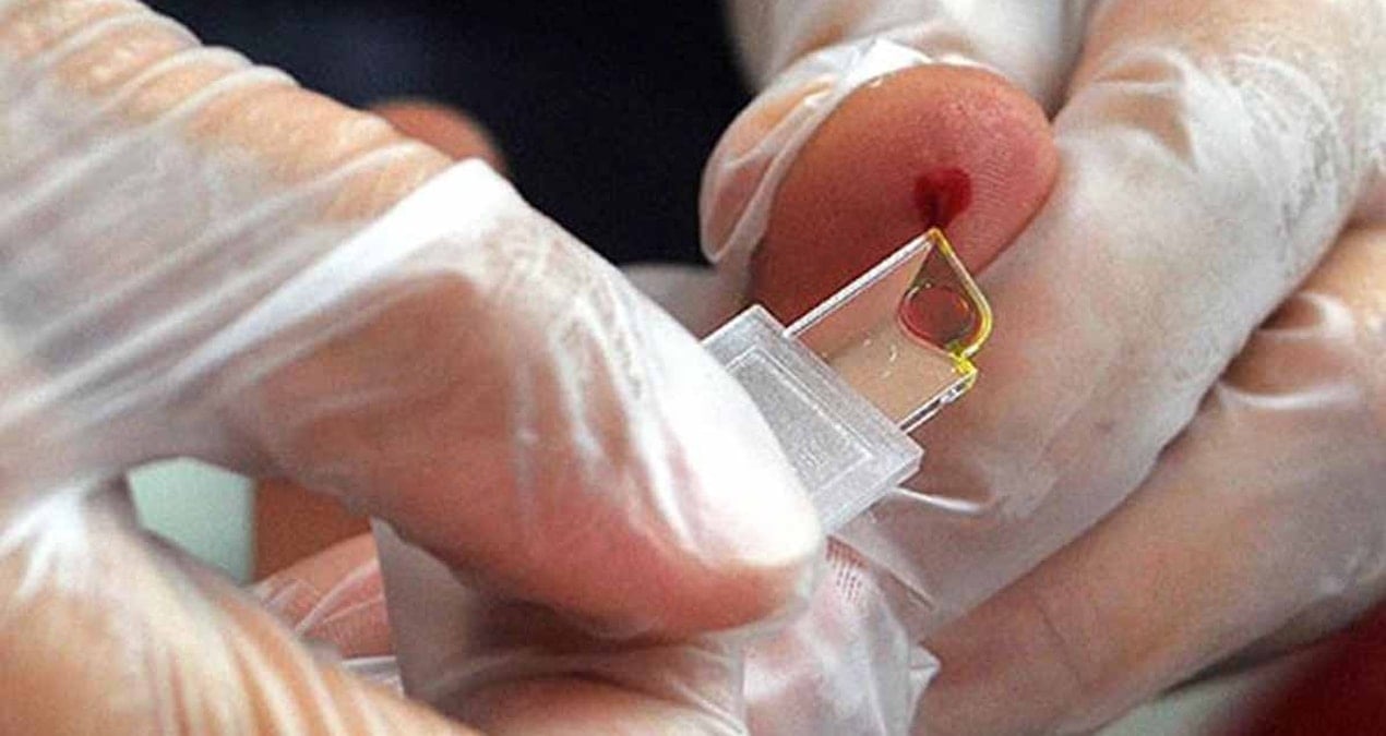 Ne A, ne B, ne de O: Yarım milyon kişiden sadece üçünün sahip olduğu çok nadir bir ‘melez’ kan grubu bulundu